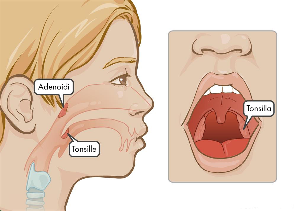 adenoidid